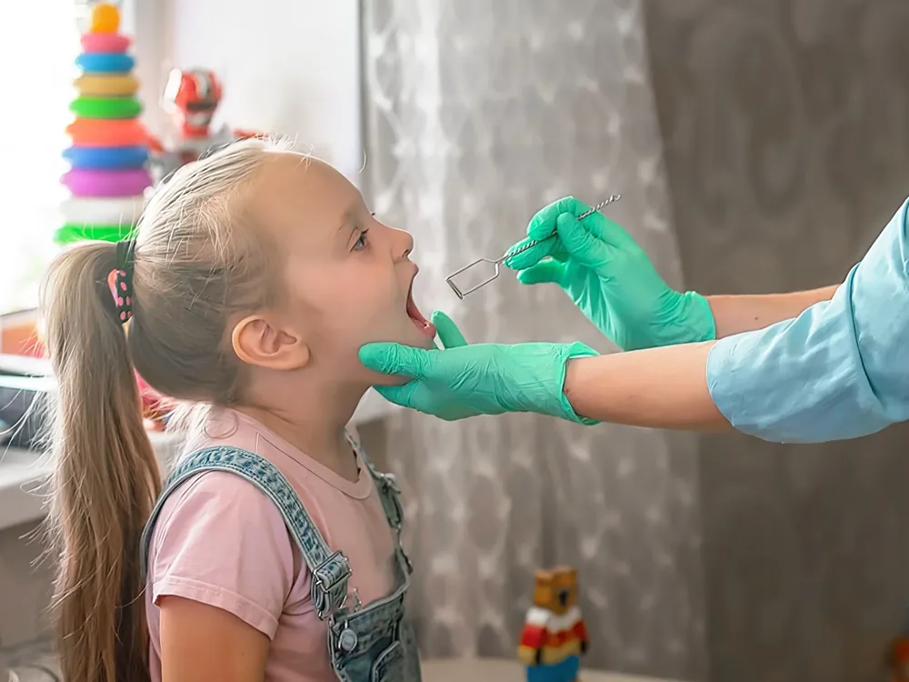 Logopedske sonde obuka